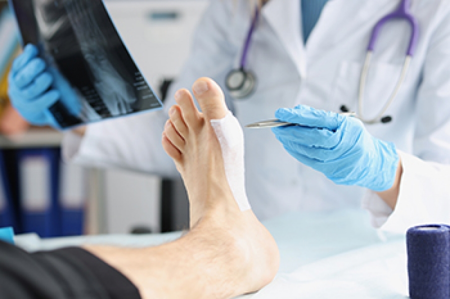 minimally-invasive-surgery-for-heel-spurs